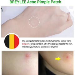 22 Patches Invisible Acne Pimple Patch Made with Tea Tree Exact Waterproof & Breathable Acne Pimple Covering Sticker