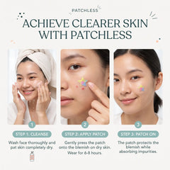 Patchless Star Pimple Patches – 432 Pack Colorful Blemish Covers