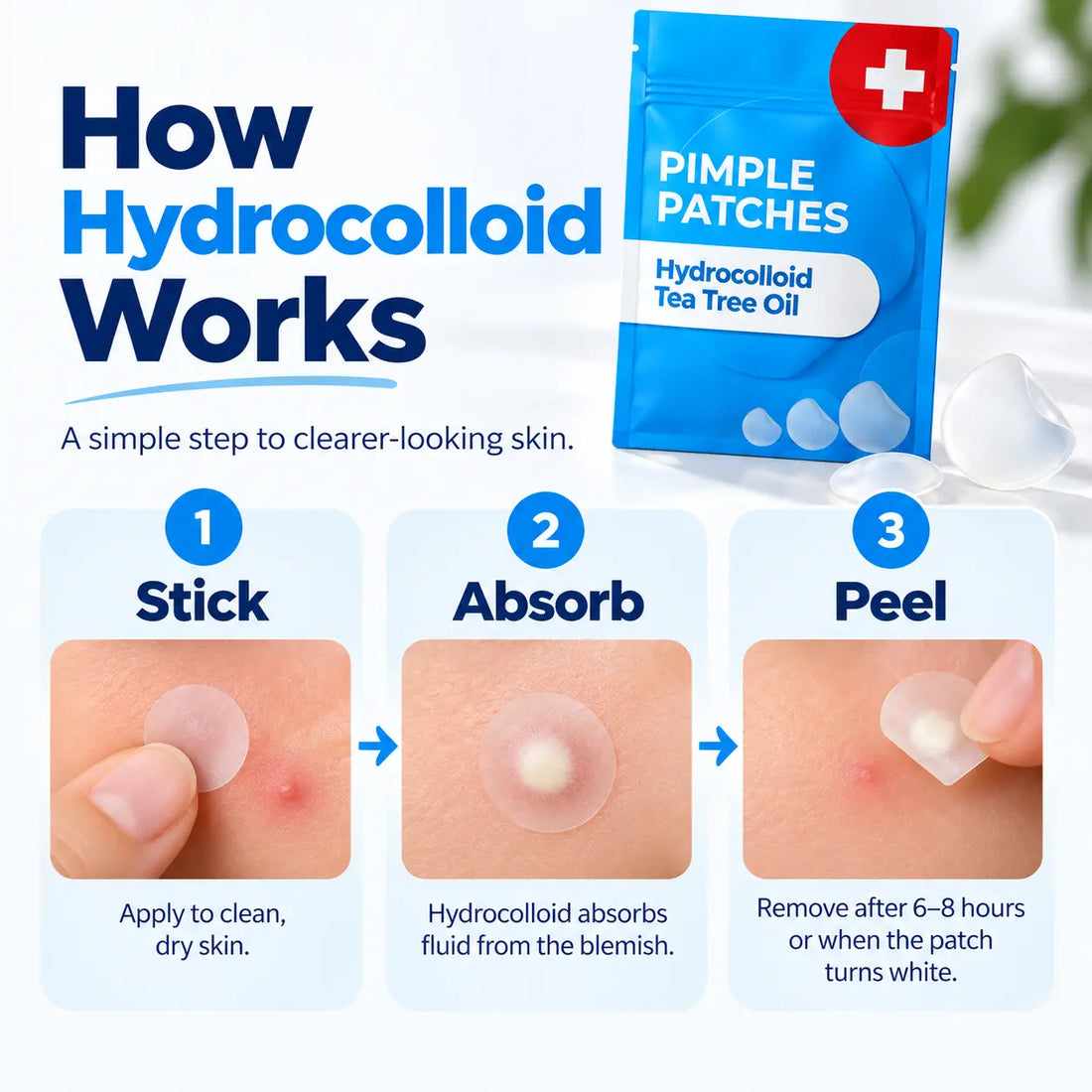 Hydrocolloid Pimple Patches with Tea Tree Oil – 120 Pack